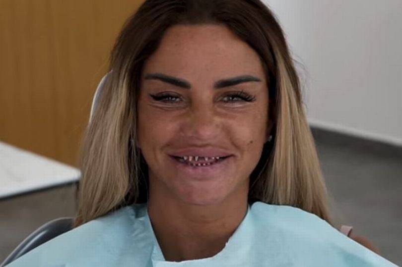 0_Katie-Price-shares-scary-video-of-her-teeth-shaved-down-to-pegs-as-she-gets-new-teeth.jpg