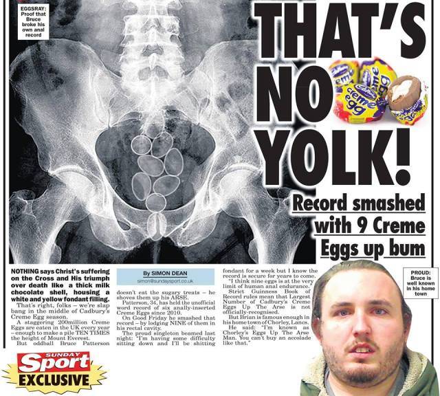 creme-eggs-up-arse.jpg