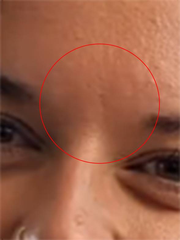 Forehead2.jpg