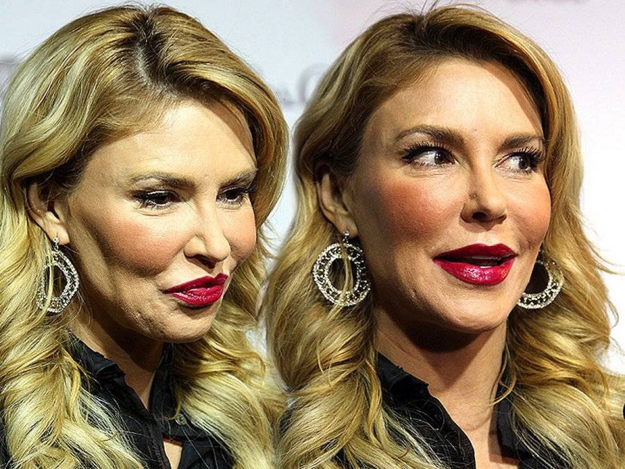 MAIN-Brandi-Glanville-makes-a-shock-admission-about-her-face.jpg